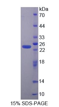 Recombinant Squamous Cell Carcinoma Antigen 1/2 (SCCA1/SCCA2)