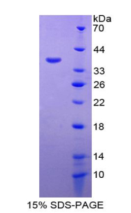 Recombinant Interleukin 6 Receptor (IL6R)