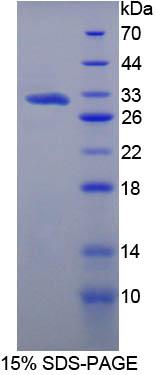 Recombinant Versican (VCAN)