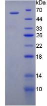 Recombinant Vascular Endothelial Growth Factor Receptor 1 (VEGFR1)