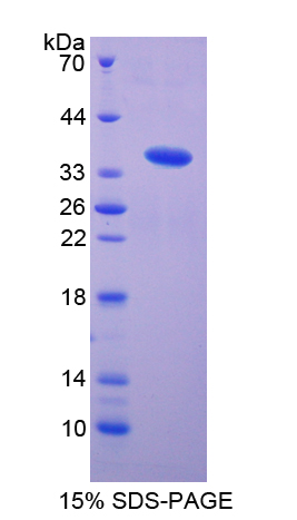 Recombinant Vascular Endothelial Growth Factor Receptor 1 (VEGFR1)