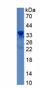 Recombinant Complement Component 9 (C9)