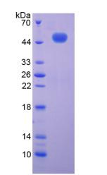 Recombinant Complement Component 9 (C9)