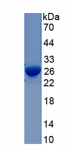 Recombinant Complement Component 9 (C9)