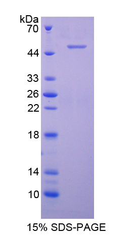 Recombinant Complement Component 9 (C9)