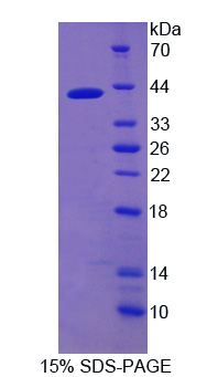 Recombinant Nuclear Factor Kappa B (NFkB)