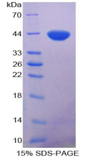 Recombinant Nuclear Factor Kappa B (NFkB)