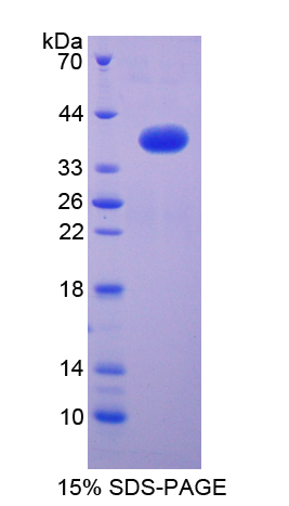 Recombinant Nuclear Factor Kappa B2 (NFkB2)