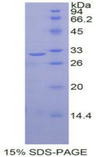 Recombinant V-Rel Reticuloendotheliosis Viral Oncogene Homolog B (RELB)