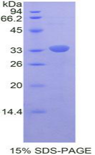 Recombinant V-Rel Reticuloendotheliosis Viral Oncogene Homolog B (RELB)