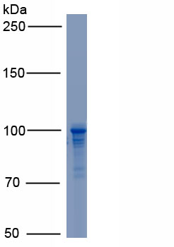 Recombinant Transglutaminase 2 (TGM2)