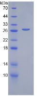 Recombinant Complement Factor D (CFD)