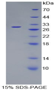 Recombinant Coagulation Factor XI (F11)