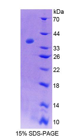 Recombinant Interleukin 2 Receptor Alpha (IL2Ra)