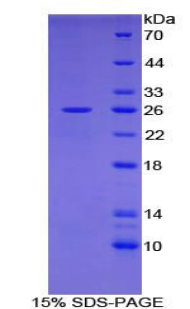 Recombinant Interleukin 2 Receptor Alpha (IL2Ra)