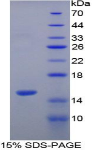 Recombinant Vinculin (VCL)