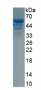 Recombinant Vinculin (VCL)