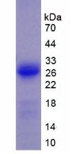 Recombinant Vinculin (VCL)