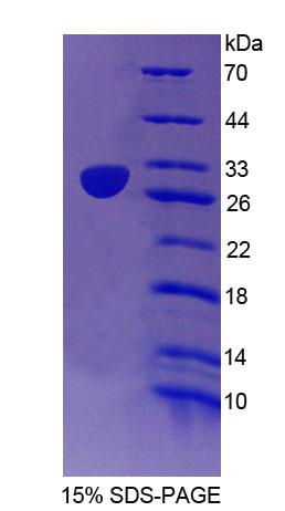 Recombinant Signaling Lymphocytic Activation Molecule Family, Member 2 (SLAMF2)