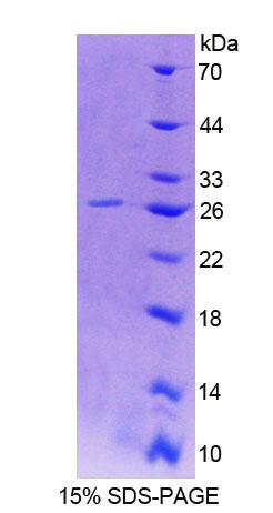 Recombinant Signaling Lymphocytic Activation Molecule Family, Member 2 (SLAMF2)