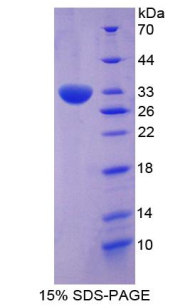 Recombinant Paxillin (PXN)