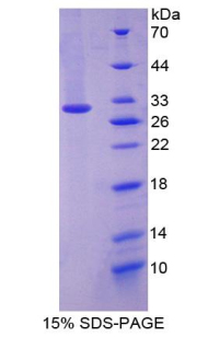 Recombinant Paxillin (PXN)