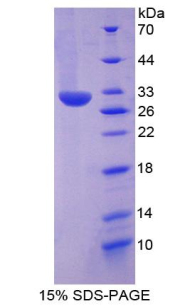 Recombinant Paxillin (PXN)