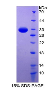 Recombinant Inhibitory Subunit Of NF Kappa B Beta (IkBb)