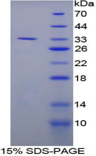 Recombinant Lectin Like Oxidized Low Density Lipoprotein Receptor 1 (LOX1)