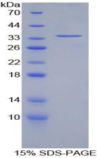 Recombinant Lectin Like Oxidized Low Density Lipoprotein Receptor 1 (LOX1)