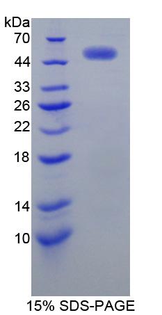 Recombinant Receptor Tyrosine Protein Kinase erbB-2 (ErbB2)