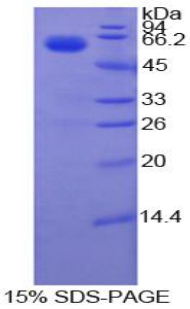 Recombinant Coagulation Factor VII (F7)