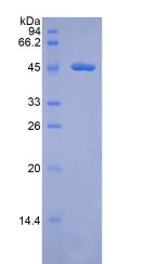 Recombinant Coagulation Factor VII (F7)