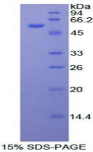 Recombinant Forkhead Box P3 (FOXP3)