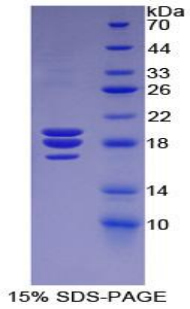 Recombinant Coagulation Factor VIII (F8)