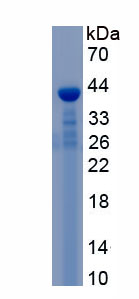 Recombinant Coagulation Factor VIII (F8)