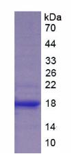 Recombinant Coagulation Factor VIII (F8)