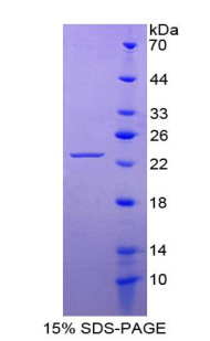 RPB882Hu01.jpg