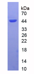 Recombinant Angiotensin I Converting Enzyme 2 (ACE2)