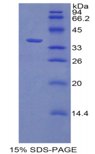 Recombinant Cyclin Dependent Kinase 2 (CDK2)