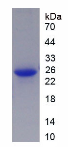 Recombinant Cyclin Dependent Kinase 2 (CDK2)