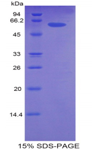 Recombinant Cyclin Dependent Kinase 2 (CDK2)