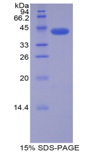 Recombinant Cyclin Dependent Kinase 2 (CDK2)