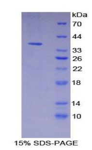 Recombinant Vascular Endothelial Growth Factor Receptor 3 (VEGFR3)