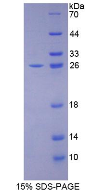 Recombinant Cadherin, Heart (CDHH)