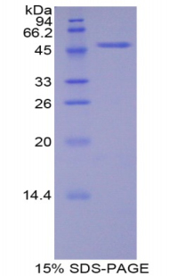 Recombinant Cadherin, Heart (CDHH)