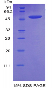 Recombinant Cadherin, Heart (CDHH)