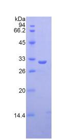 Recombinant Ficolin 3 (FCN3)