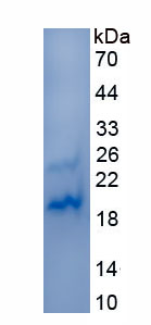 Recombinant Aggrecan (AGC)