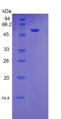 Recombinant Kallikrein 7 (KLK7)